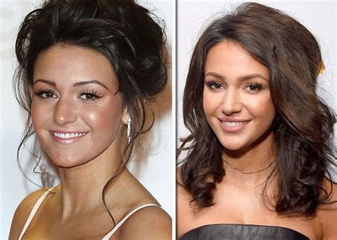 michelle keegan ears|Michelle Keegans comments on surgery after drastic。